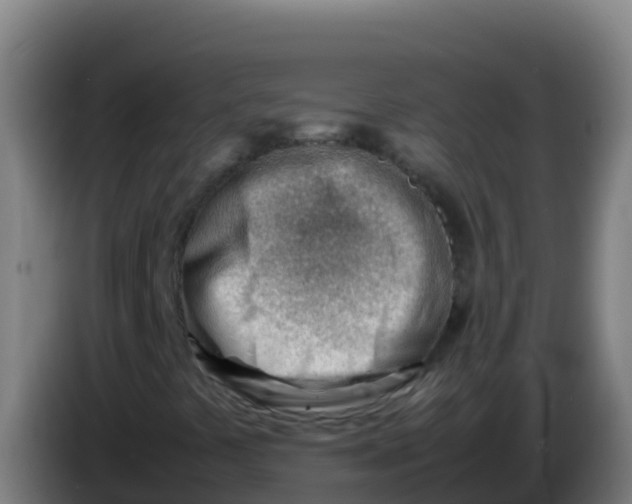 X0000086291441200704201914