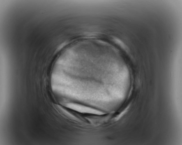 X0000086291449200704201914