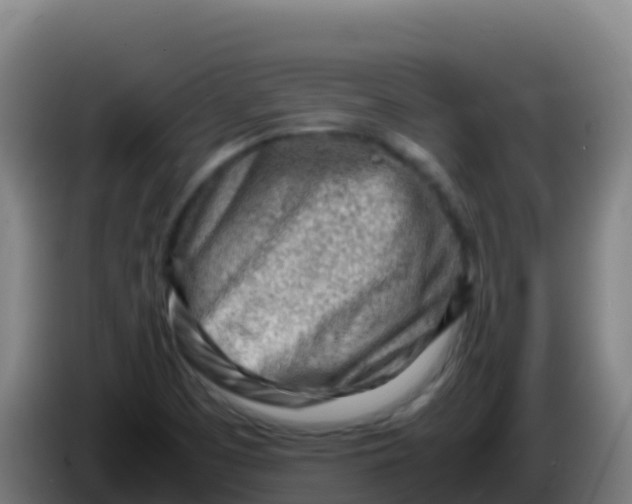 X0000086291457200704201913
