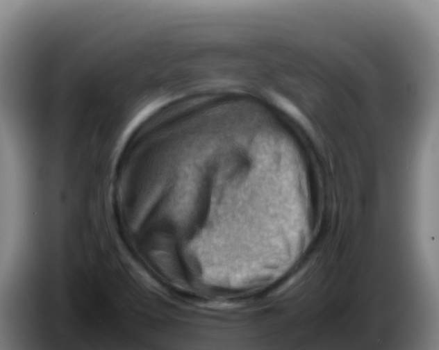 X0000086291463200704201913
