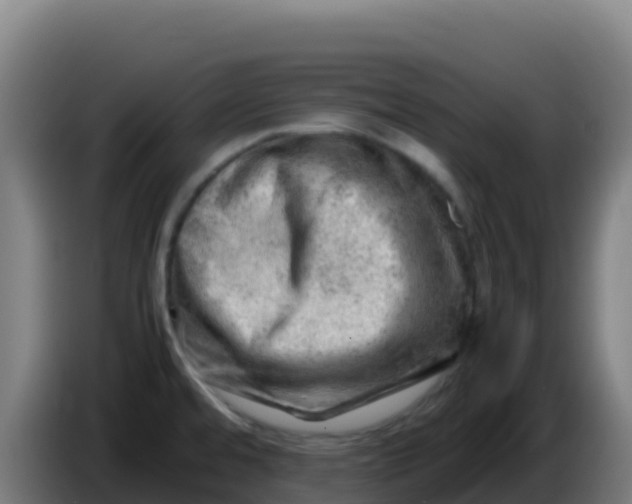X0000086291480200704201913