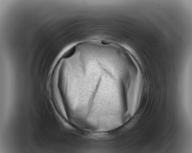 X0000086291486200704201913