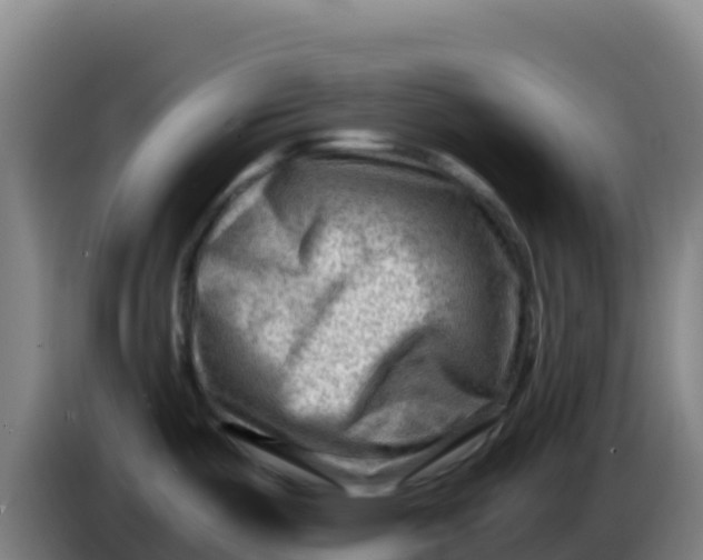 X0000086291487200704201913