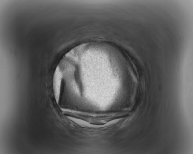 X0000086291494200704201913