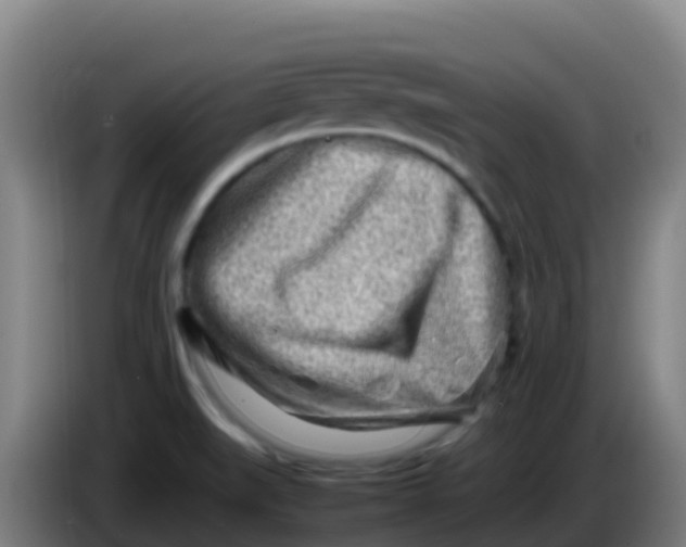 X0000086291519200704201913