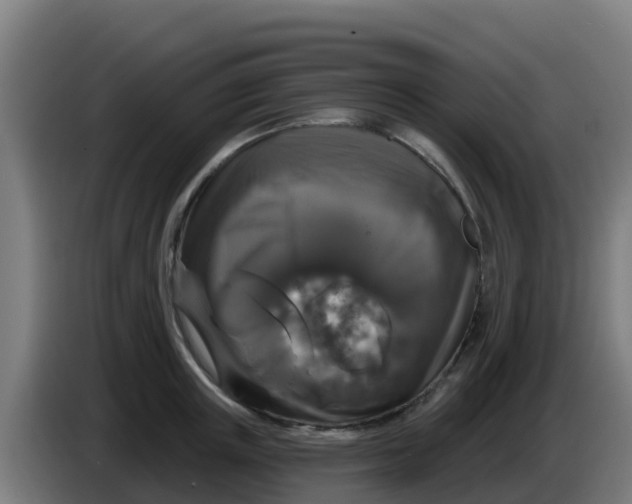 X0000086300851200704201941