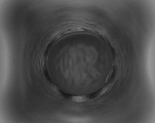 X0000086310139200704202010