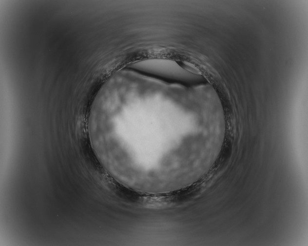 X0000086310419200704202006