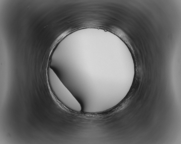 X0000086310954200704202000
