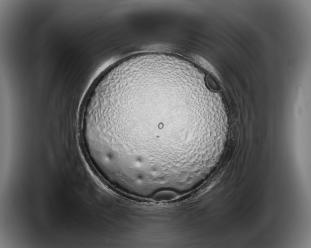 X0000086311087200704201957
