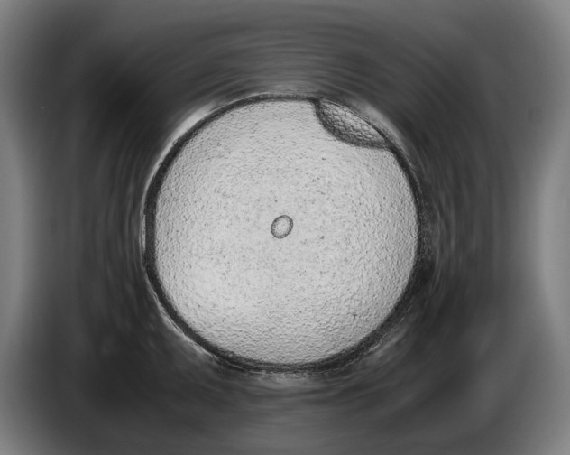 X0000086311095200704201957