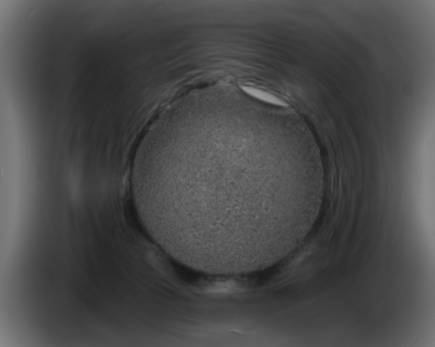 X0000086320177200704131702