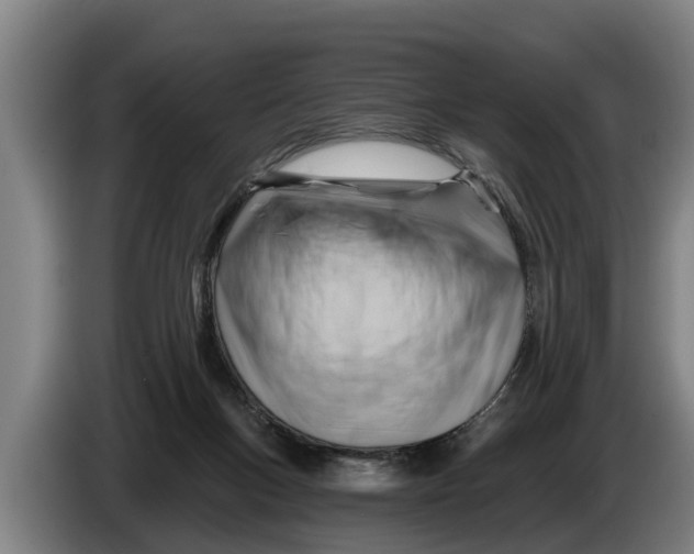 X0000086320167200704202029