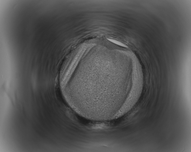 X0000086320177200704202029