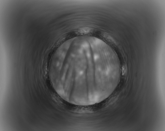 X0000086321011200704202017