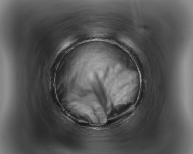 X0000086321306200704202014