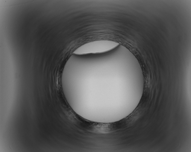 X0000086720138200704130735