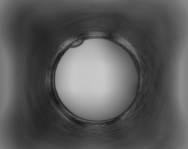 X0000086720155200704130734
