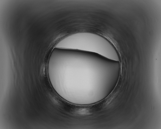 X0000086720157200704130734