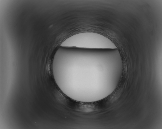 X0000086720185200704130735