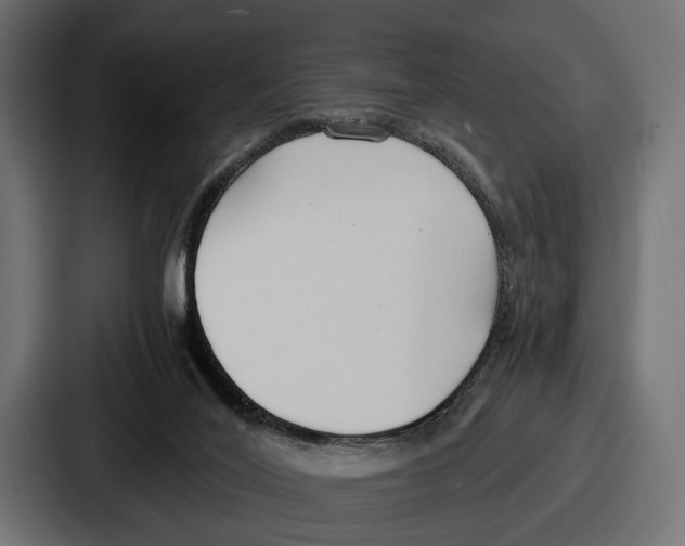 X0000086720020200705111604