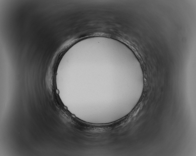 X0000086720149200705111602