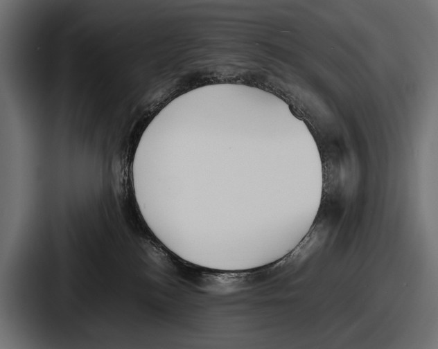 X0000086720184200705111602