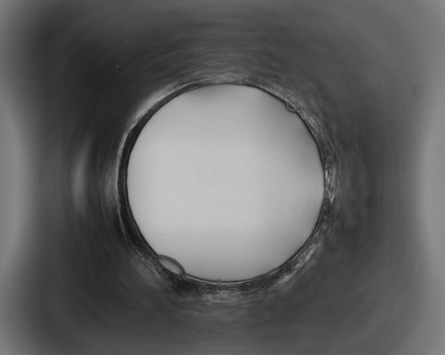 X0000086720196200705111602