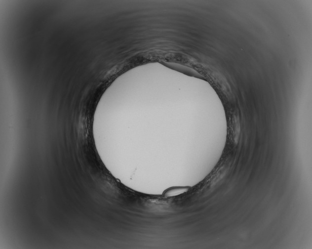 X0000086720232200705111601