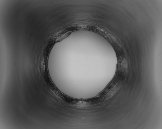 X0000086720562200705111557