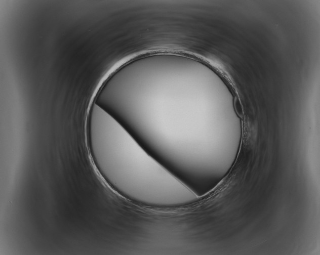 X0000086731295200704130739