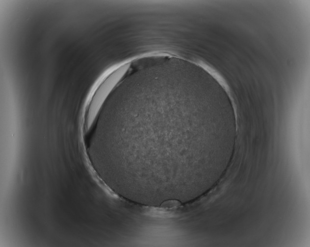 X0000086731104200704201641