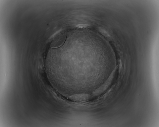 X0000086731158200704201640