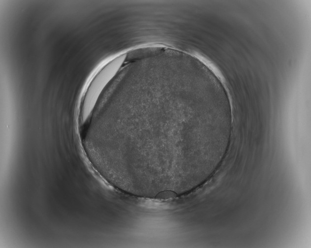 X0000086731104200704271625