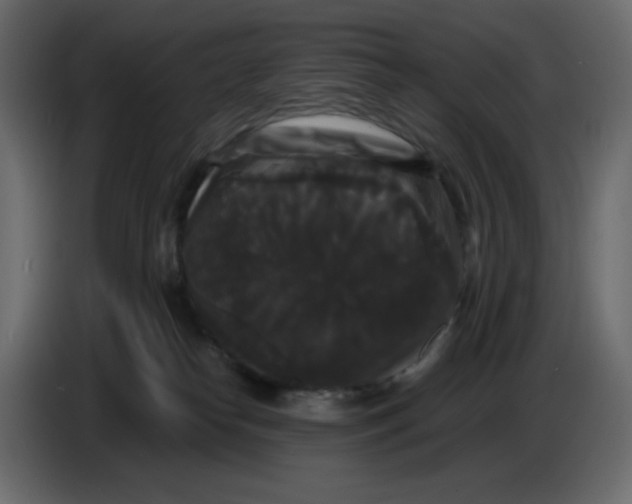 X0000086730182200705041355