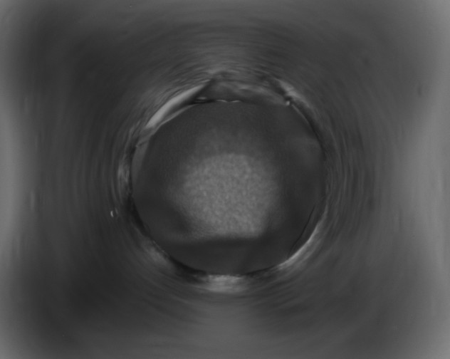 X0000086730192200705041355