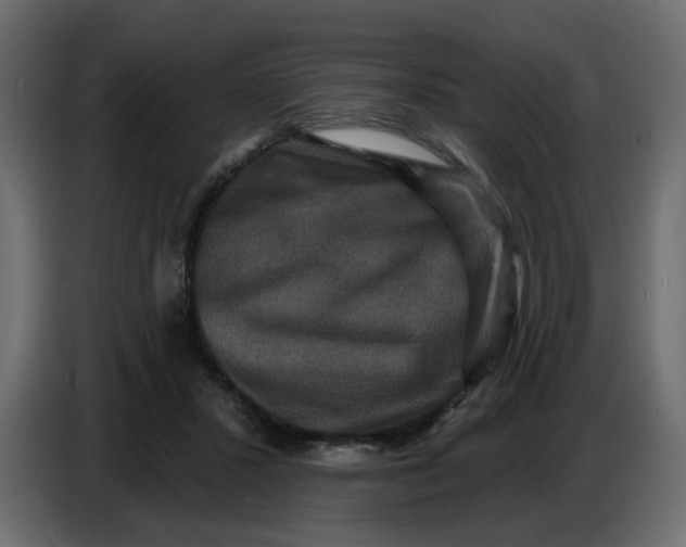 X0000086730407200705041351