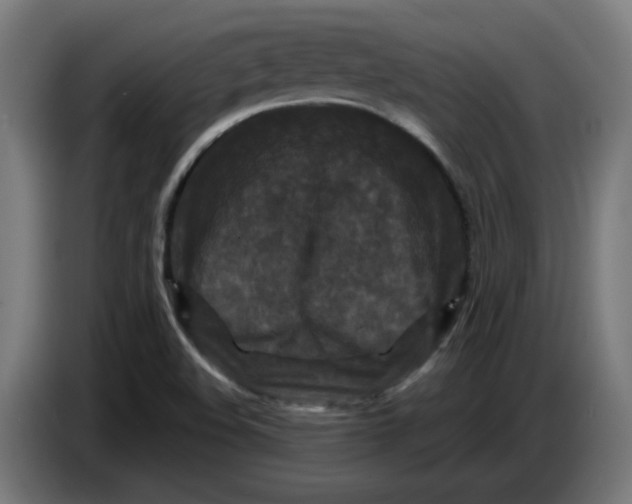 X0000086731508200705041337