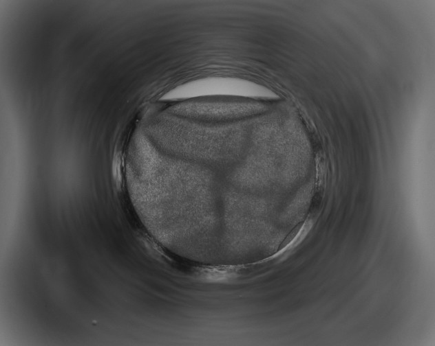 X0000086730094200705111623