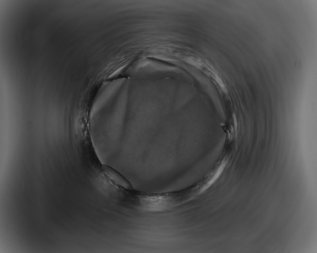 X0000086730237200705111621