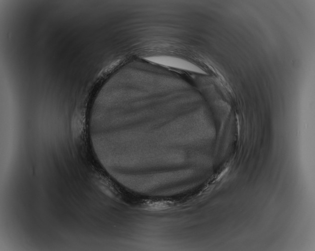 X0000086730407200705111619