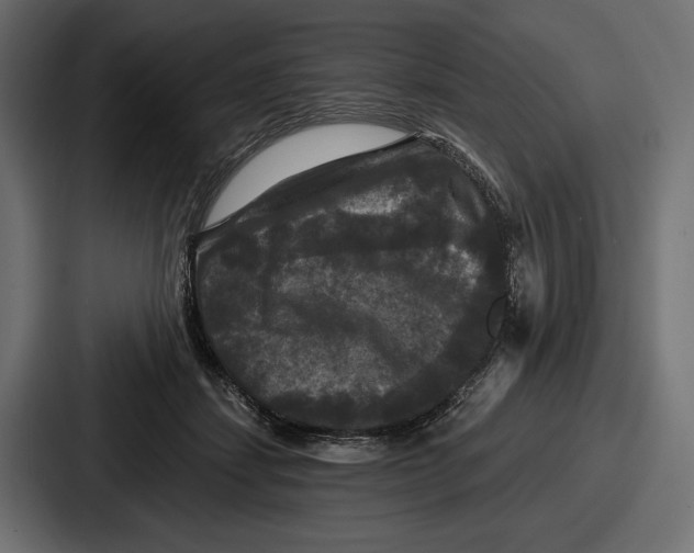 X0000086730459200705111618