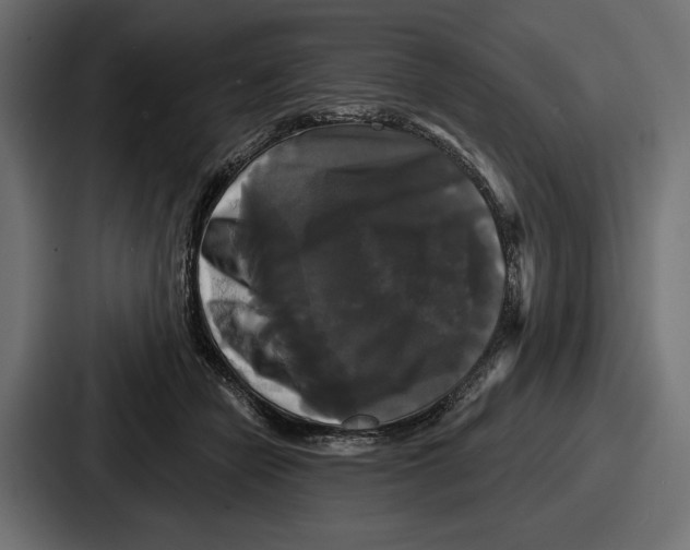 X0000086730462200705111618