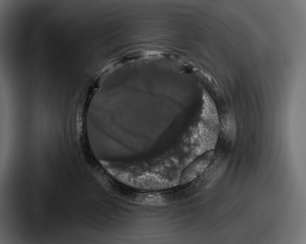 X0000086730715200705111615