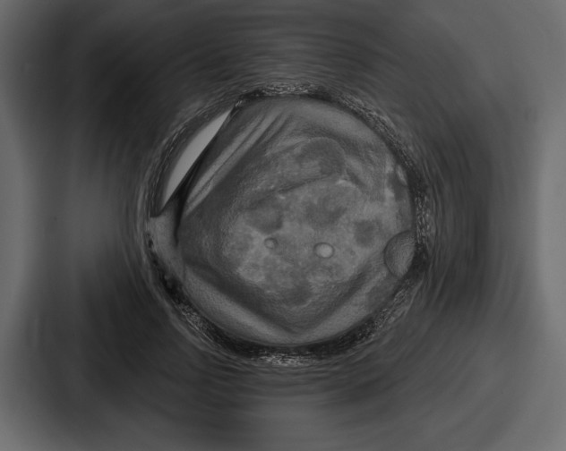 X0000086730742200705111614