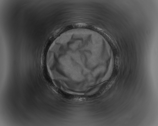 X0000086730760200705111615