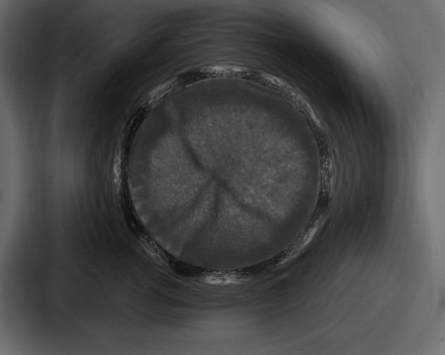 X0000086730762200705111615