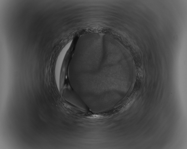 X0000086730818200705111613