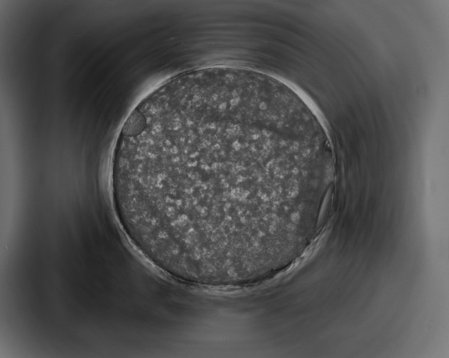 X0000086730957200705111612