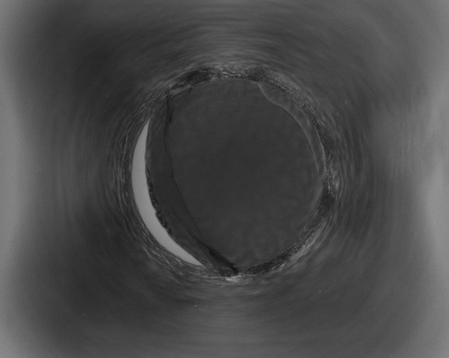 X0000086731010200705111610